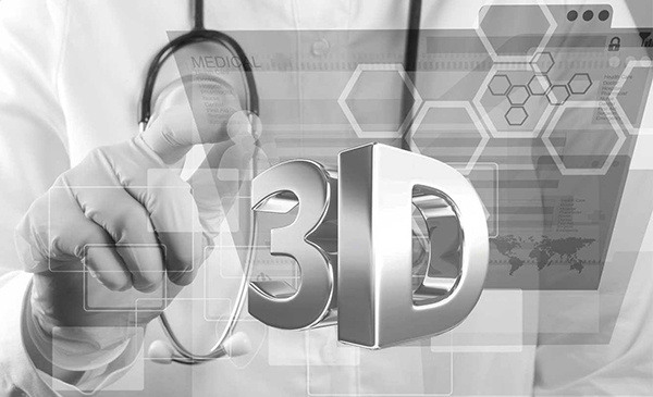 3D打印具有那些優(yōu)勢(shì)？