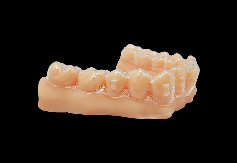 什么是3d打印正畸牙模？3d打印正畸牙模怎么做？
